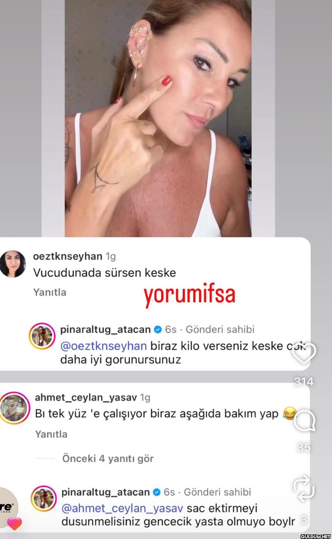 Pınar Altuğ olayı çözmüş  ...