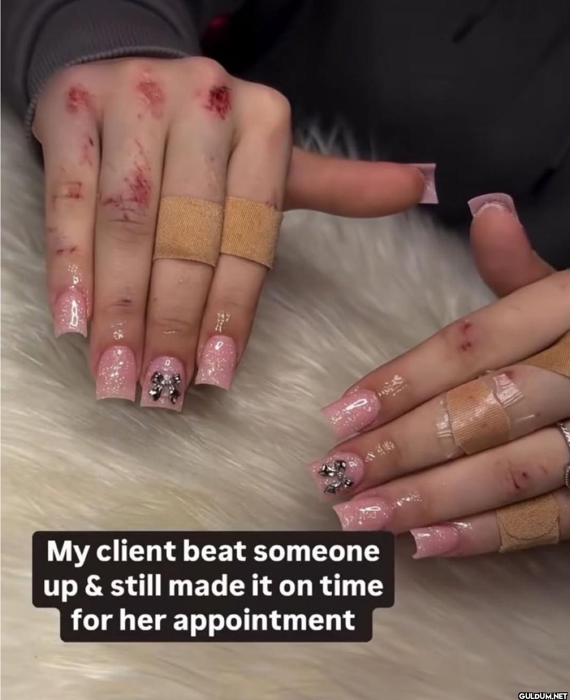 My client beat someone up...