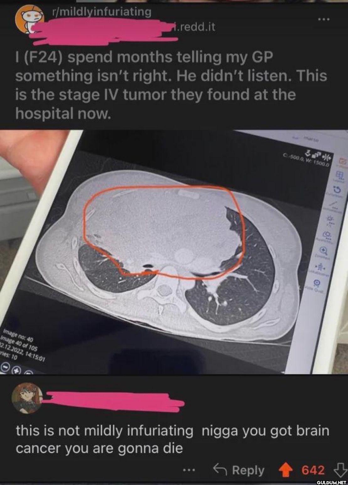 r/mildlyinfuriating...