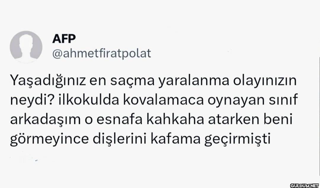 Yaşadığınız en saçma...