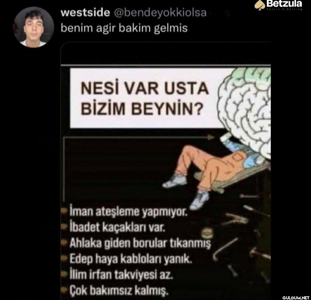benim agir bakim gelmis...