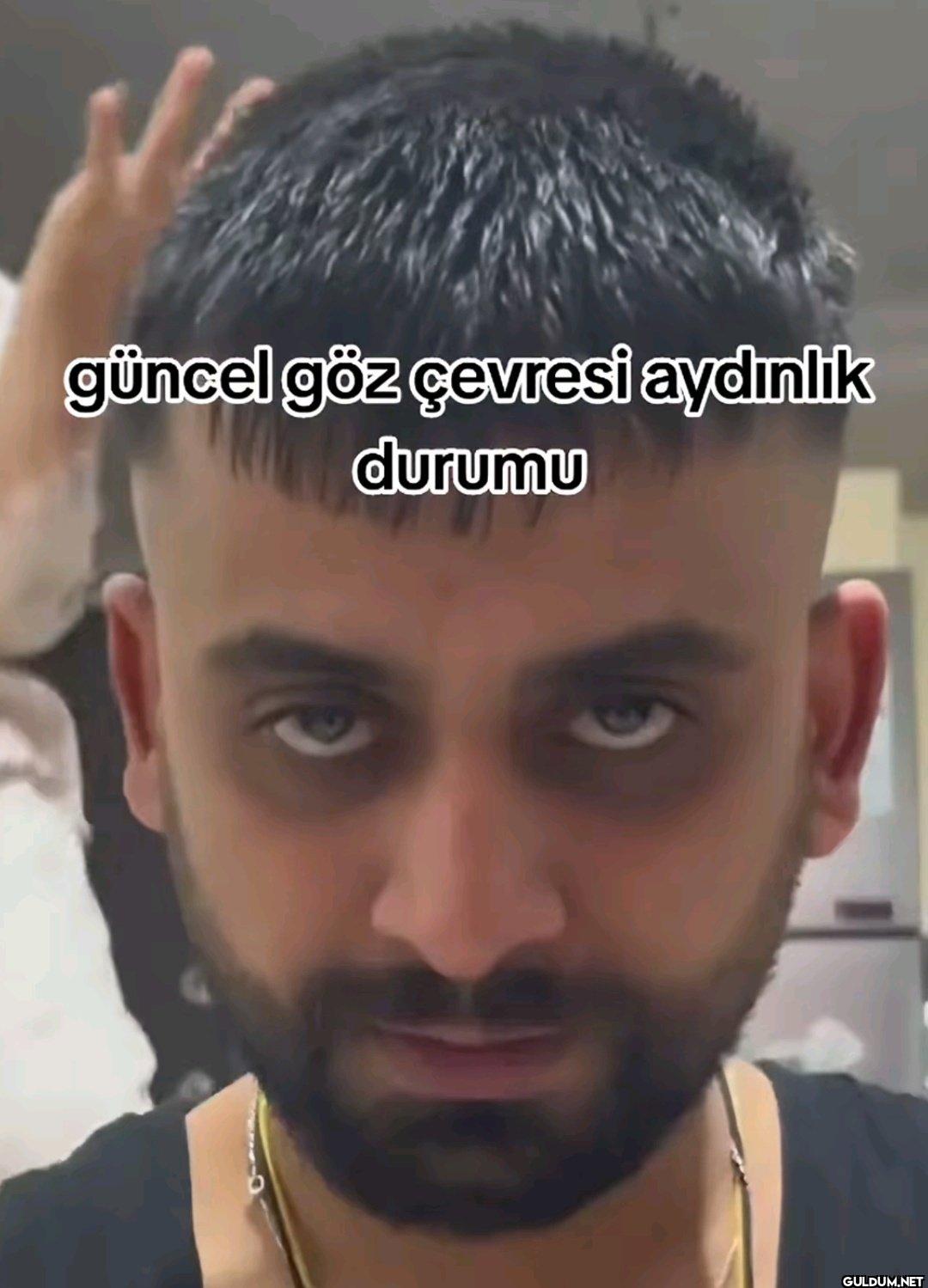 güncel göz çevresi aydınlık durumu