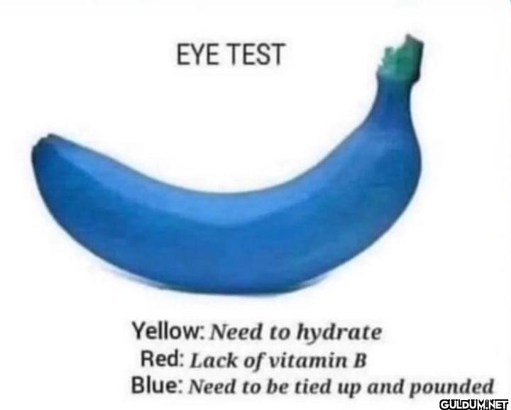 EYE TEST Yellow: Need to...