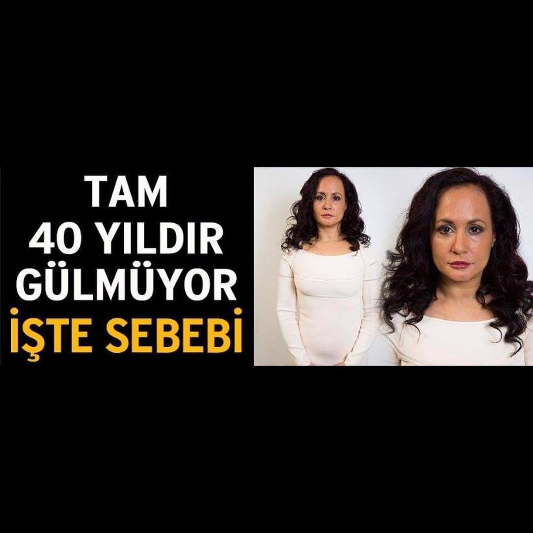 Tam 40 yıldır gülmüyor
işte sebebi