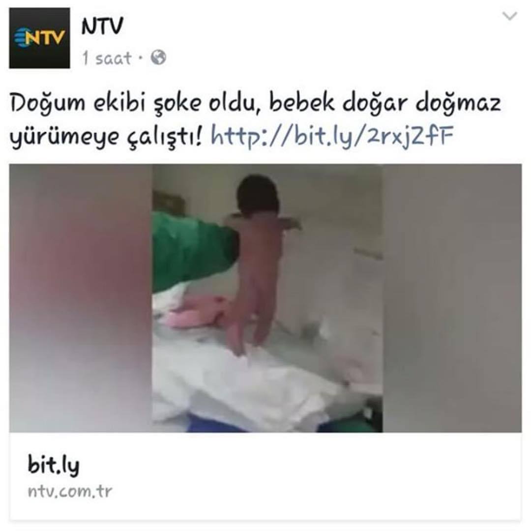 Doğum ekibi şoke oldu....