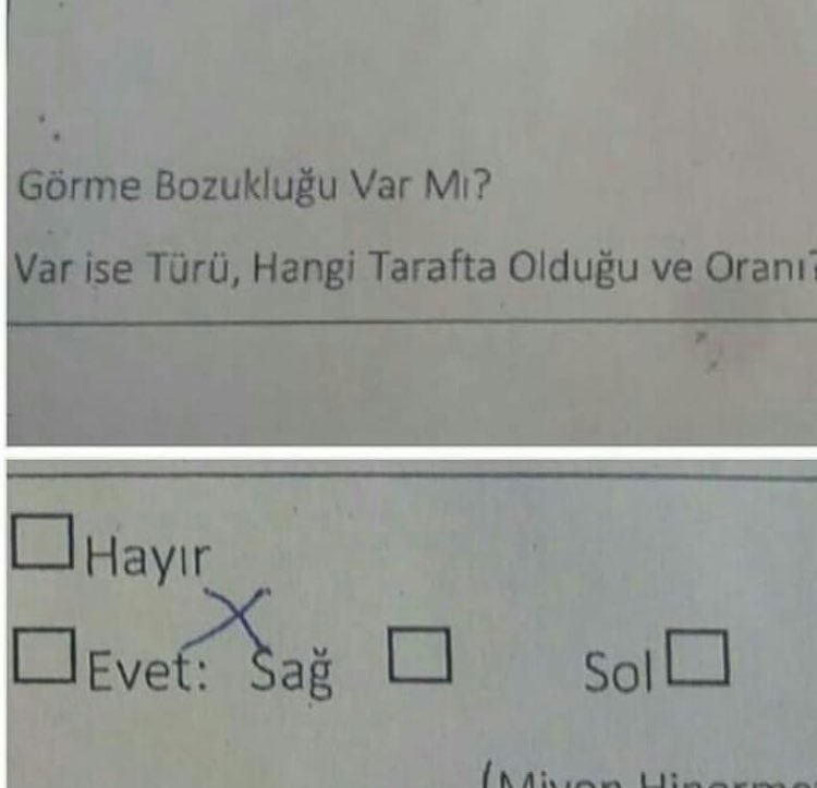 Görme bozukluğu var...