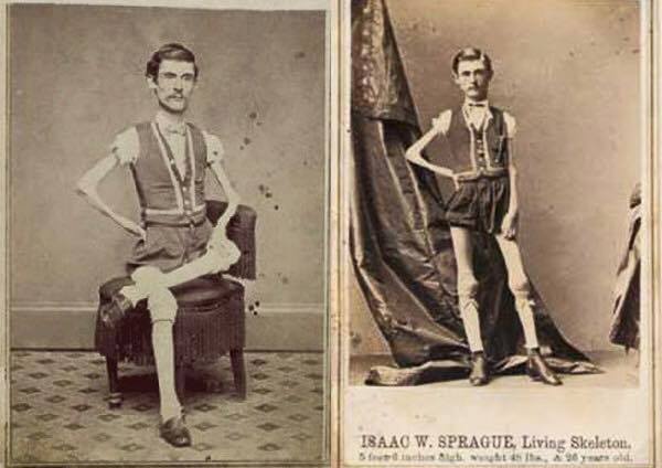 ISAAC W. SPRAGUE Living Skeleton.
