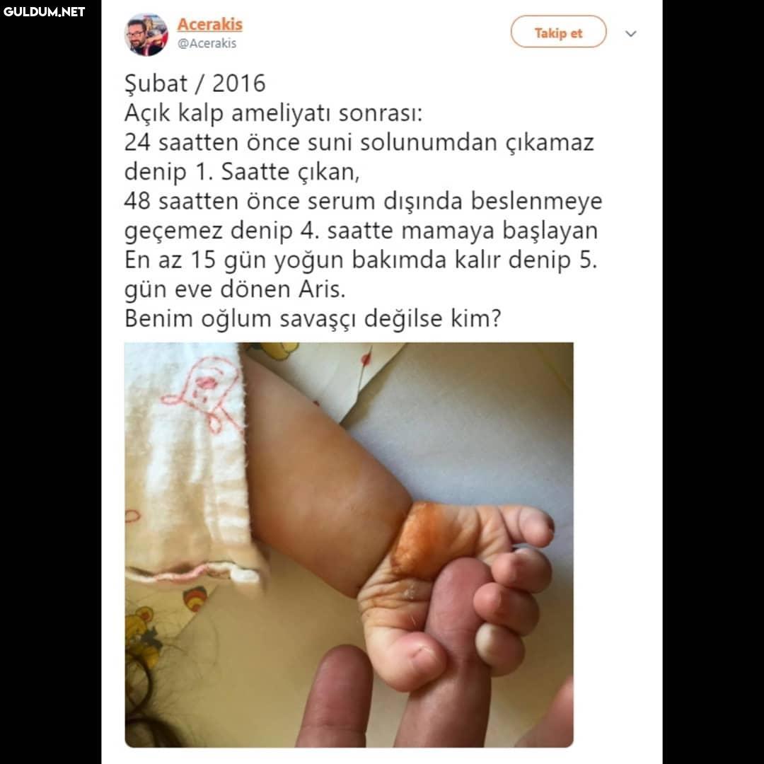 Açık kalp ameliyatı...