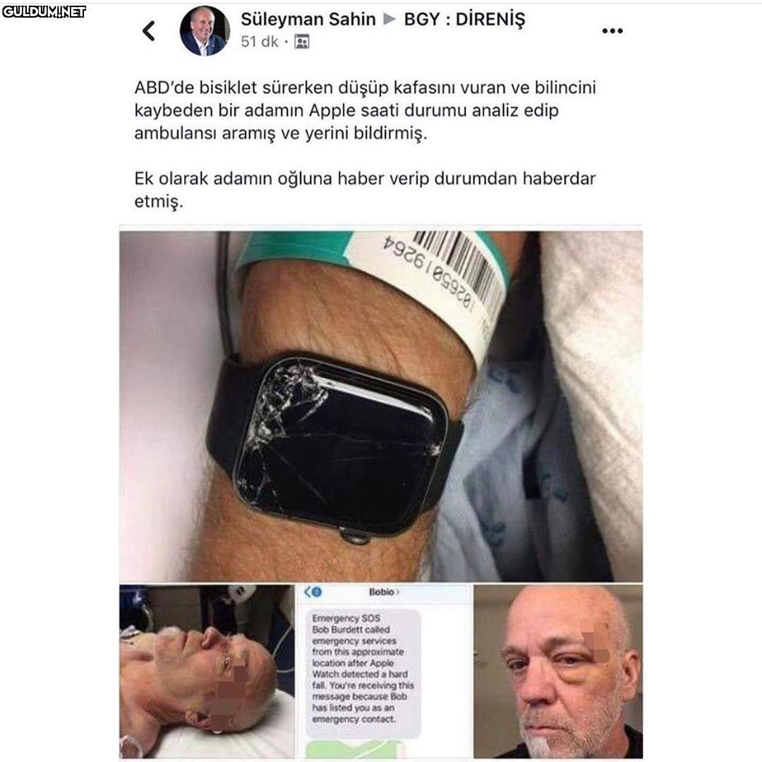 teknoloji böyle bi şey...