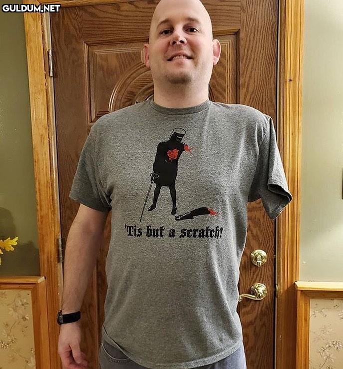 Tshirtte "Ufak bir sıyrık"...