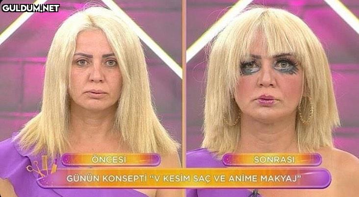 ONCESI SONRASI GÜNÜN...