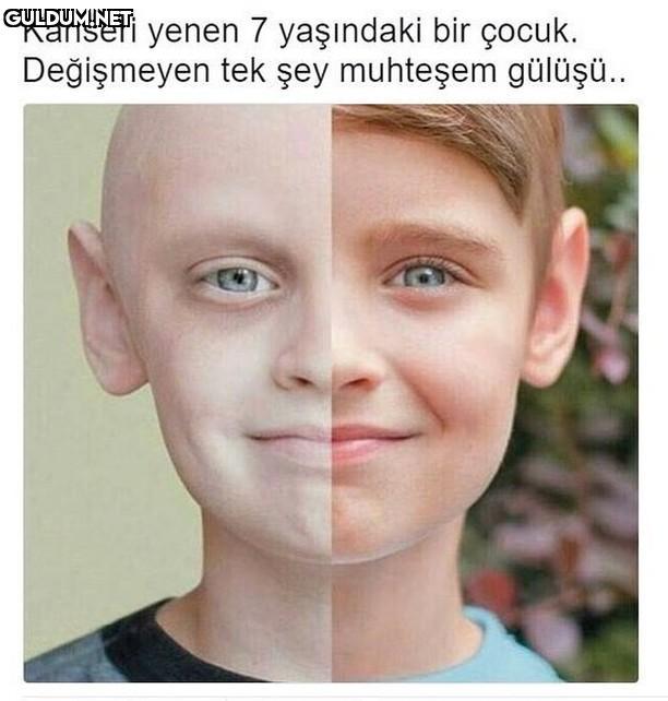 Kanseri yenen 7 yaşındaki...
