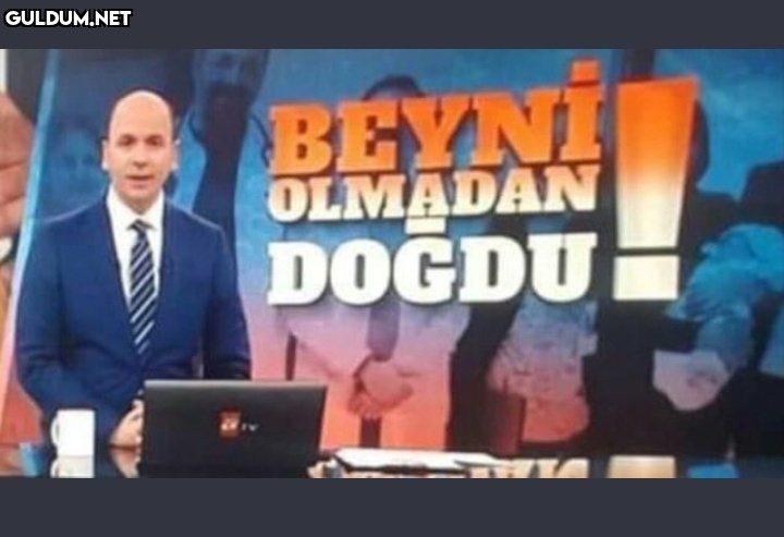 BEYNI OLMADAN DOĞDU