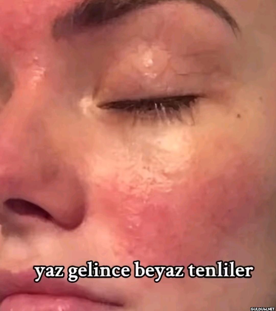 yaz gelince beyaz tenliler