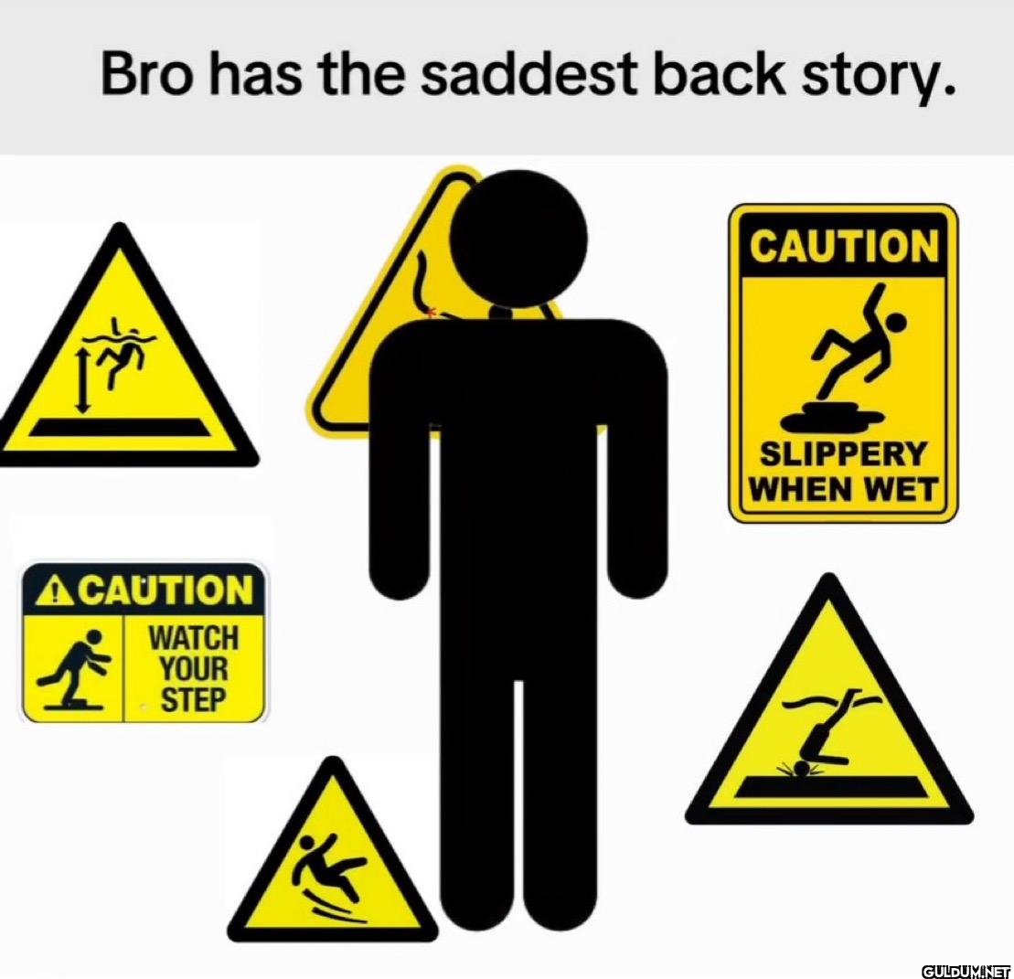 Bro has the saddest back...
