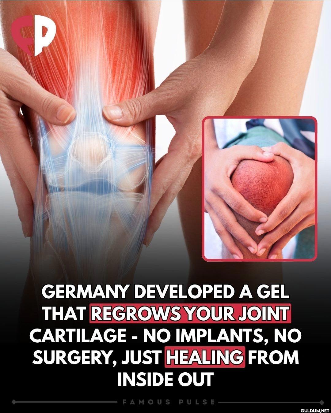 🤔    P GERMANY DEVELOPED A...