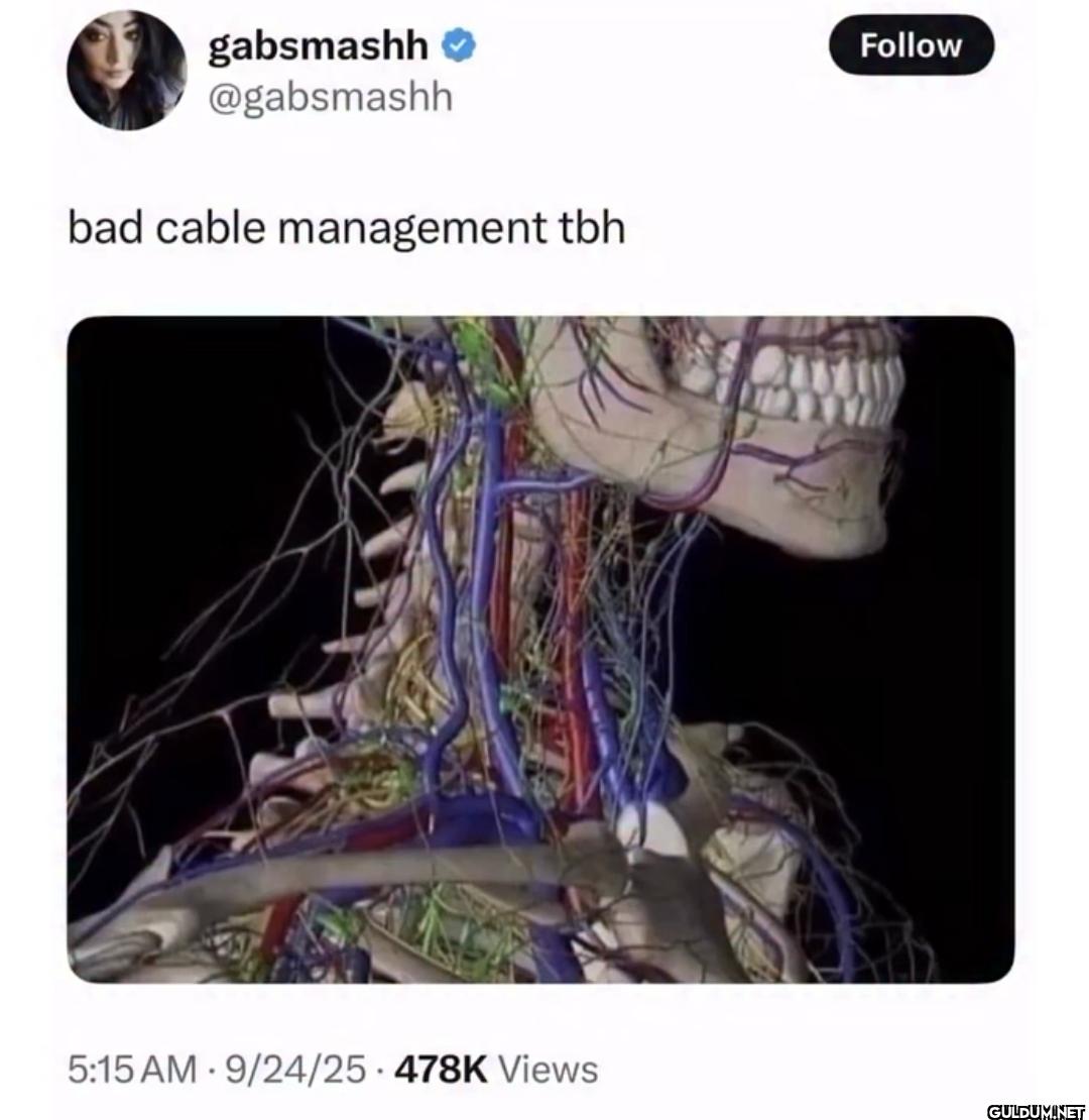 bad cable management tbh...