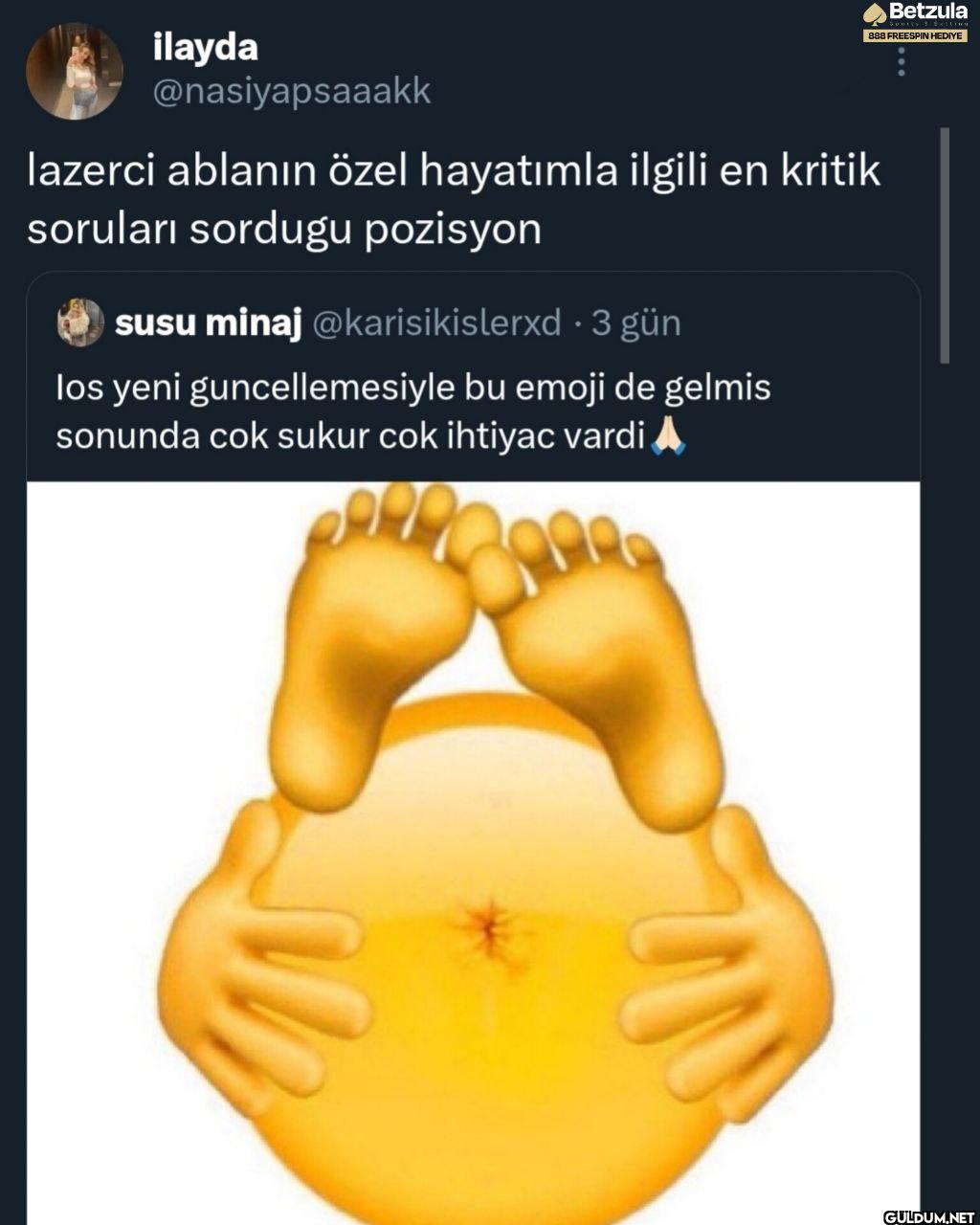 lazerci ablanın özel...