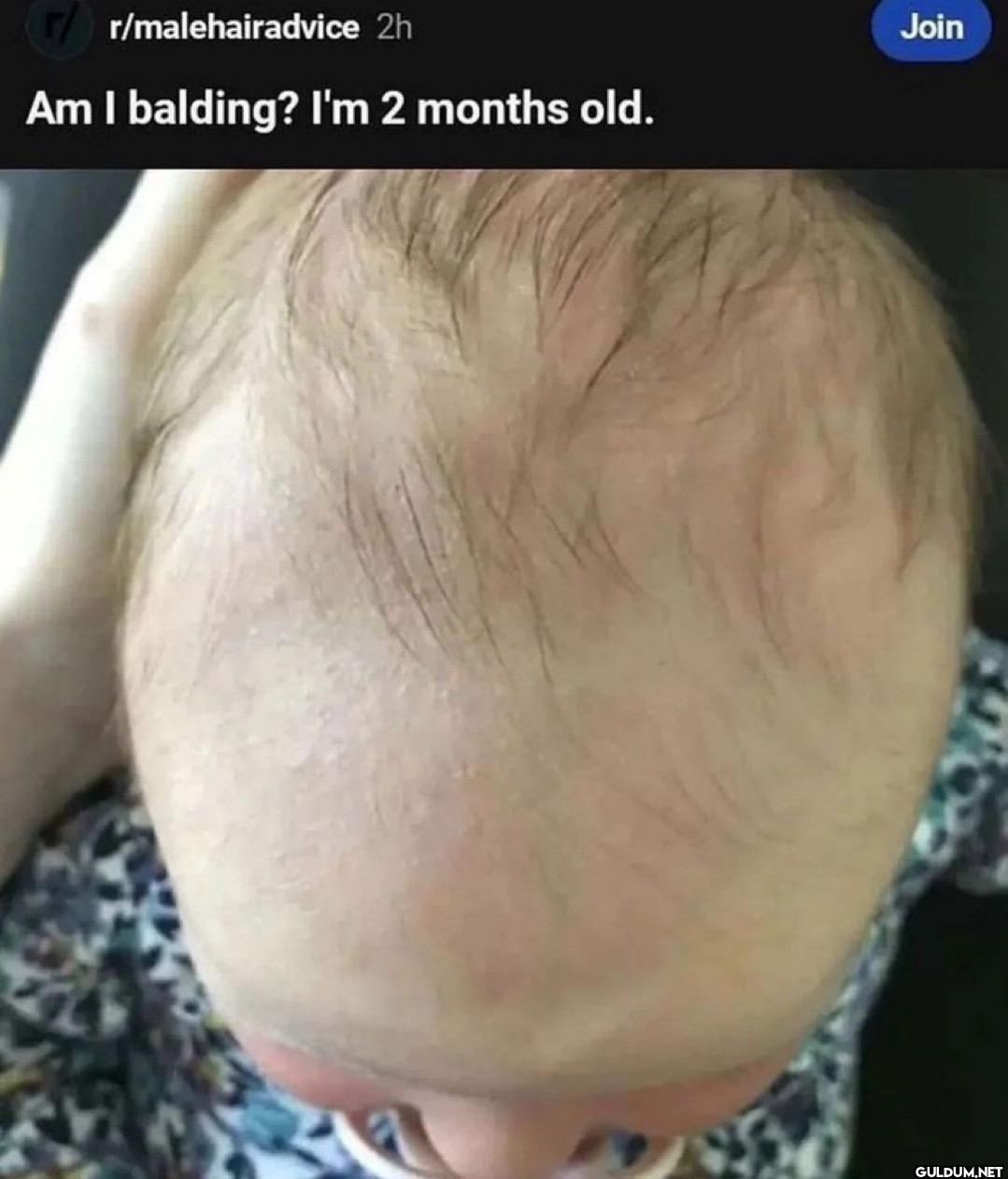 r/malehairadvice 2h Am I...