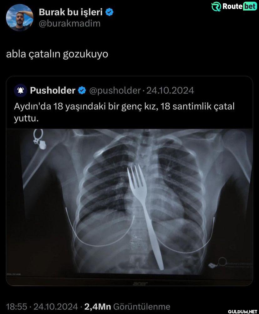 abla çatalın gozukuyo...
