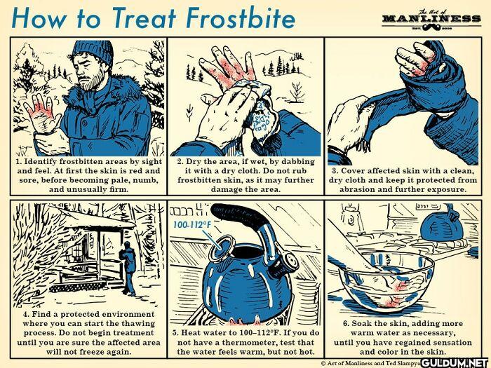 10. How To Treat Frostbite...