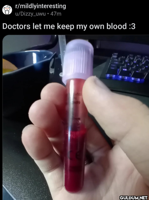 r/mildlyinteresting...