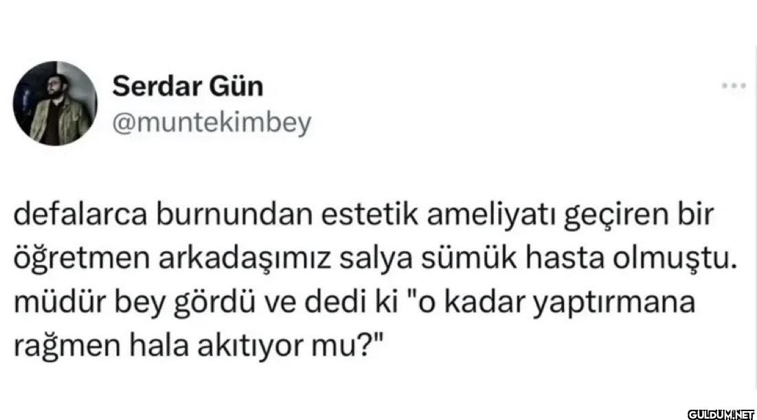 *** defalarca burnundan...