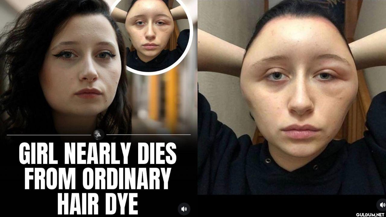 In 2018, 19-year-old...