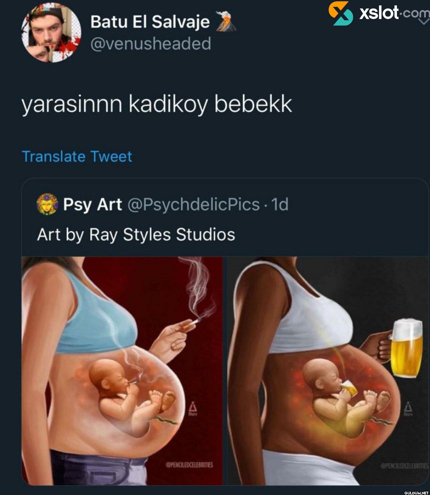 yarasinnn kadikoy bebekk...