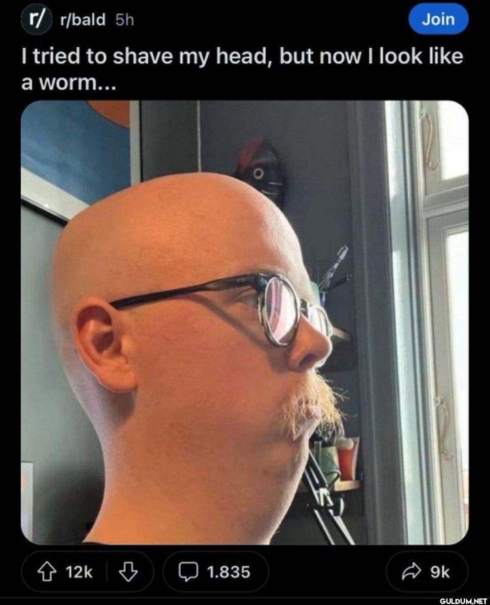 r/ r/bald 5h Join I tried...