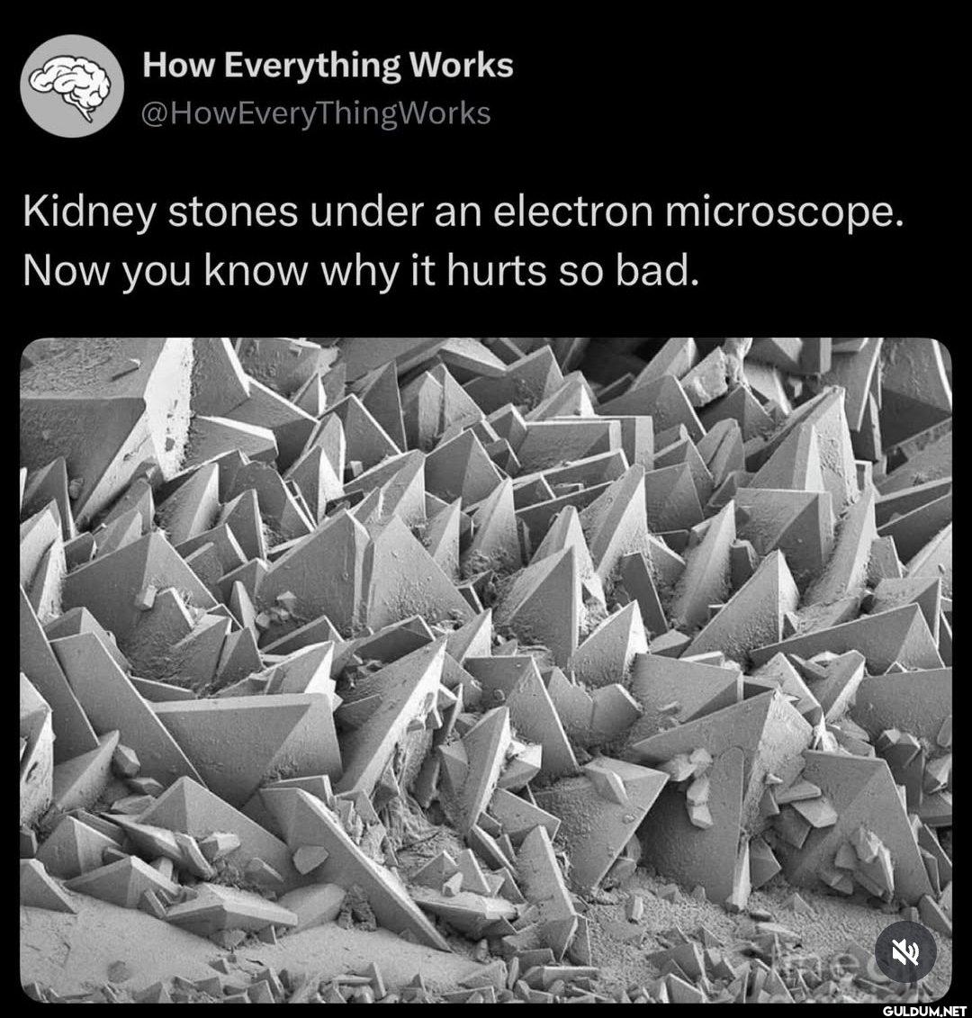 Under an electron...
