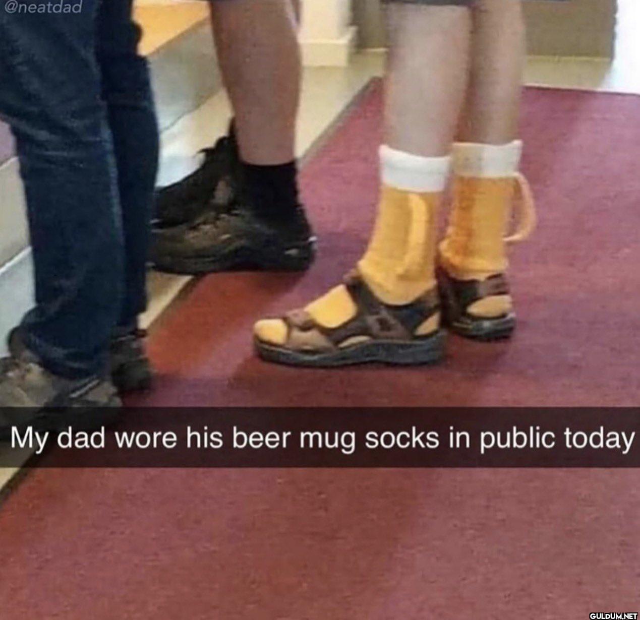 My dad wore his beer mug...