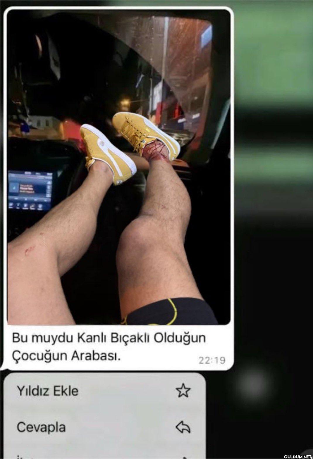 serhat Akın vurulma       ...