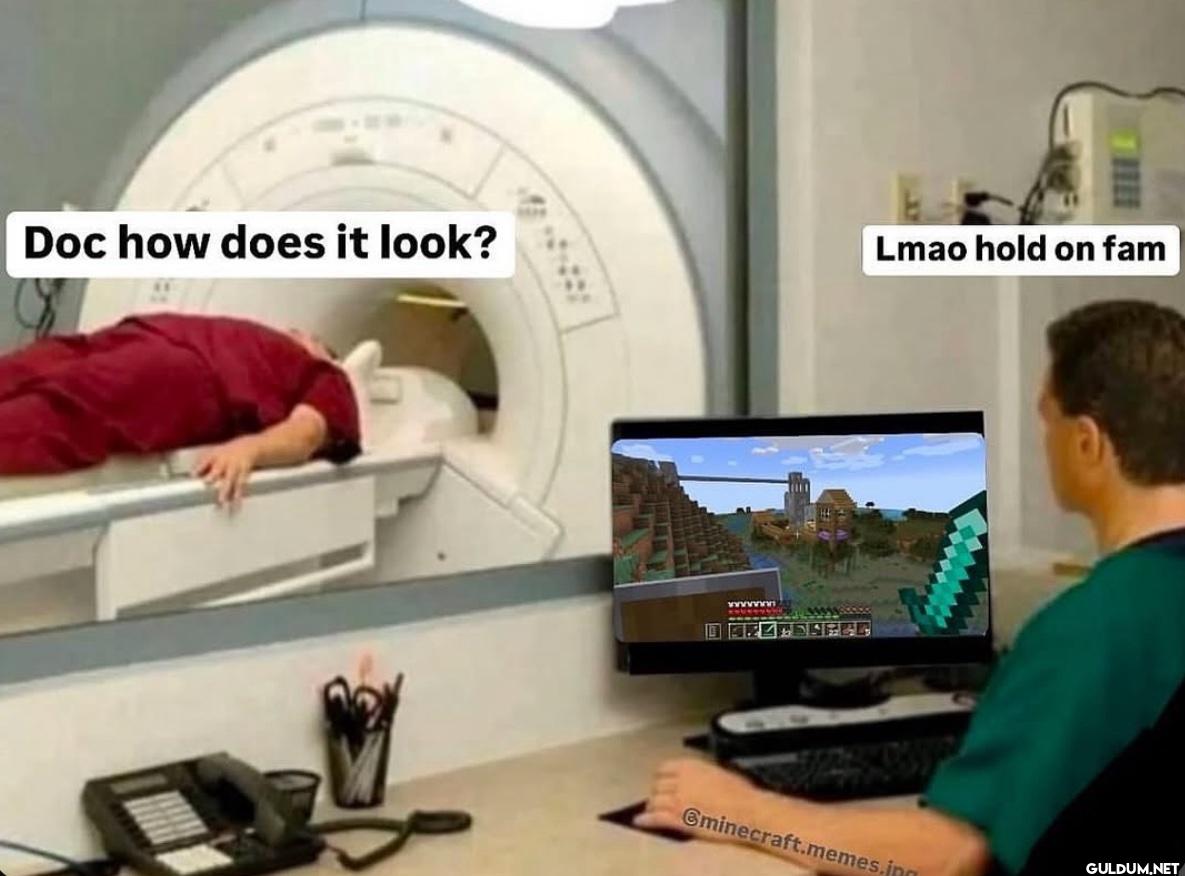 Doc how does it look? Lmao...