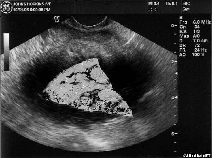 JOHNS HOPKINS IVF 10/31/06...