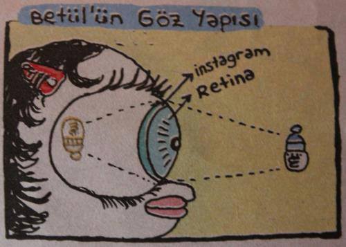 Betül'ün göz yapısı

-...