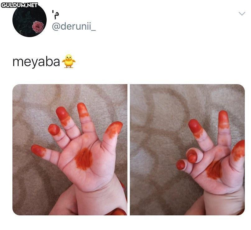 @derunii_ meyaba