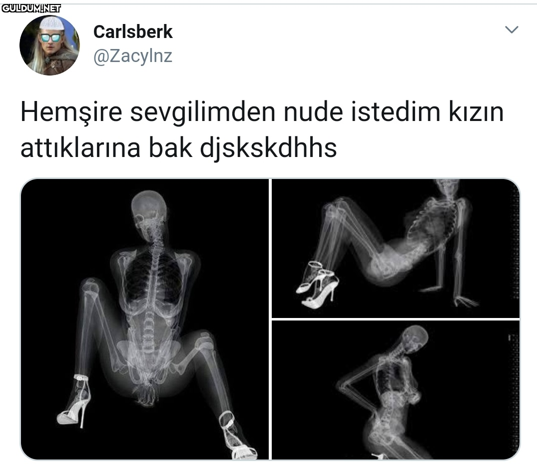 Hemşire sevgiliden nude.