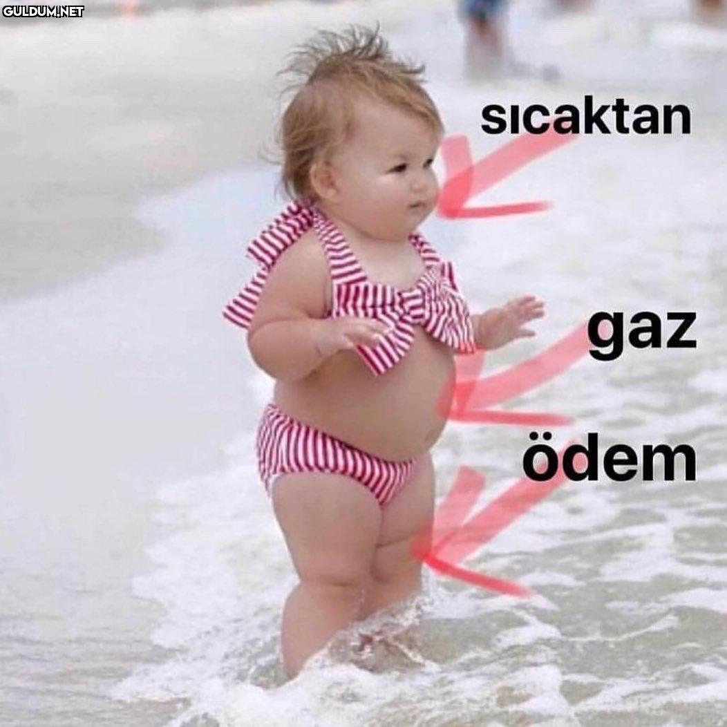 Güncel formum🧘🏻 Sıcaktan gaz ödem