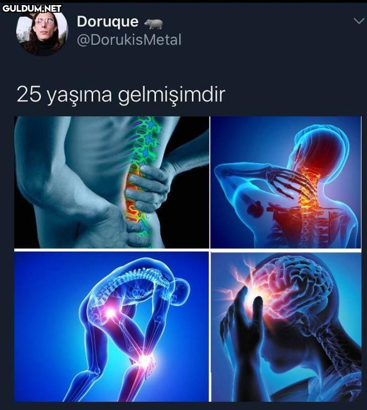 Doruque @DorukisMetal 25...