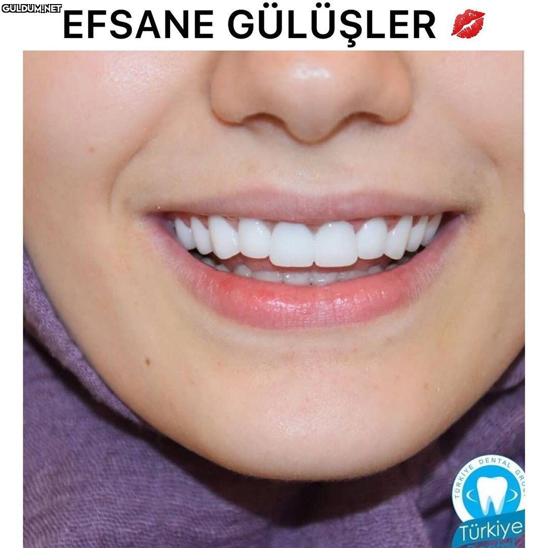 @turkeydental 👈...