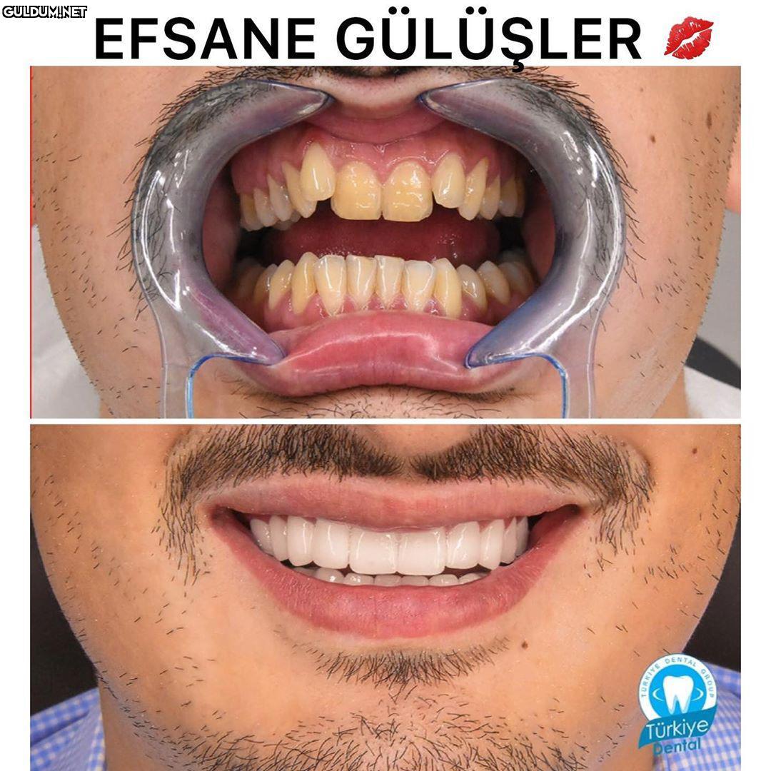 @turkeydental 👈...