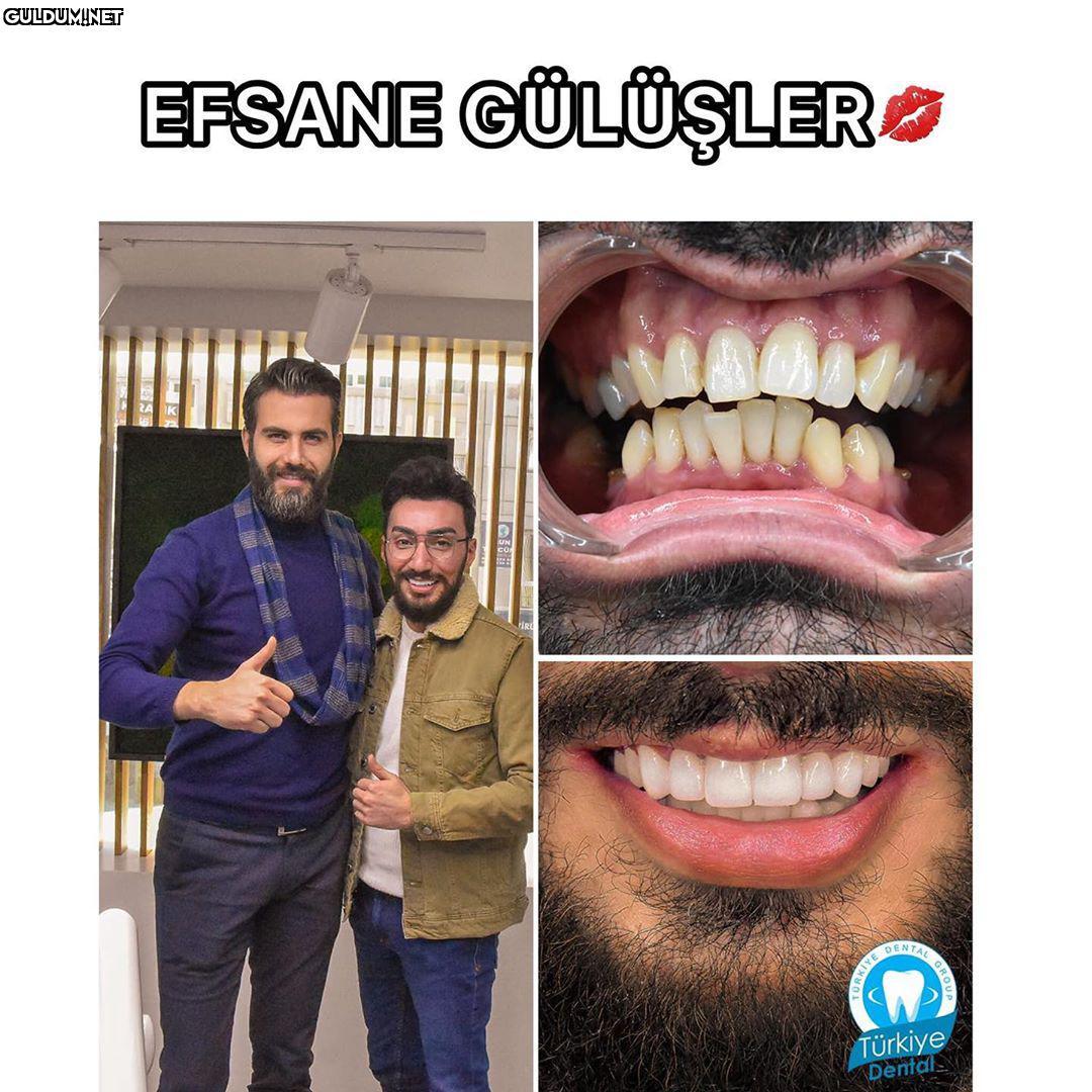 @turkeydental 👈...