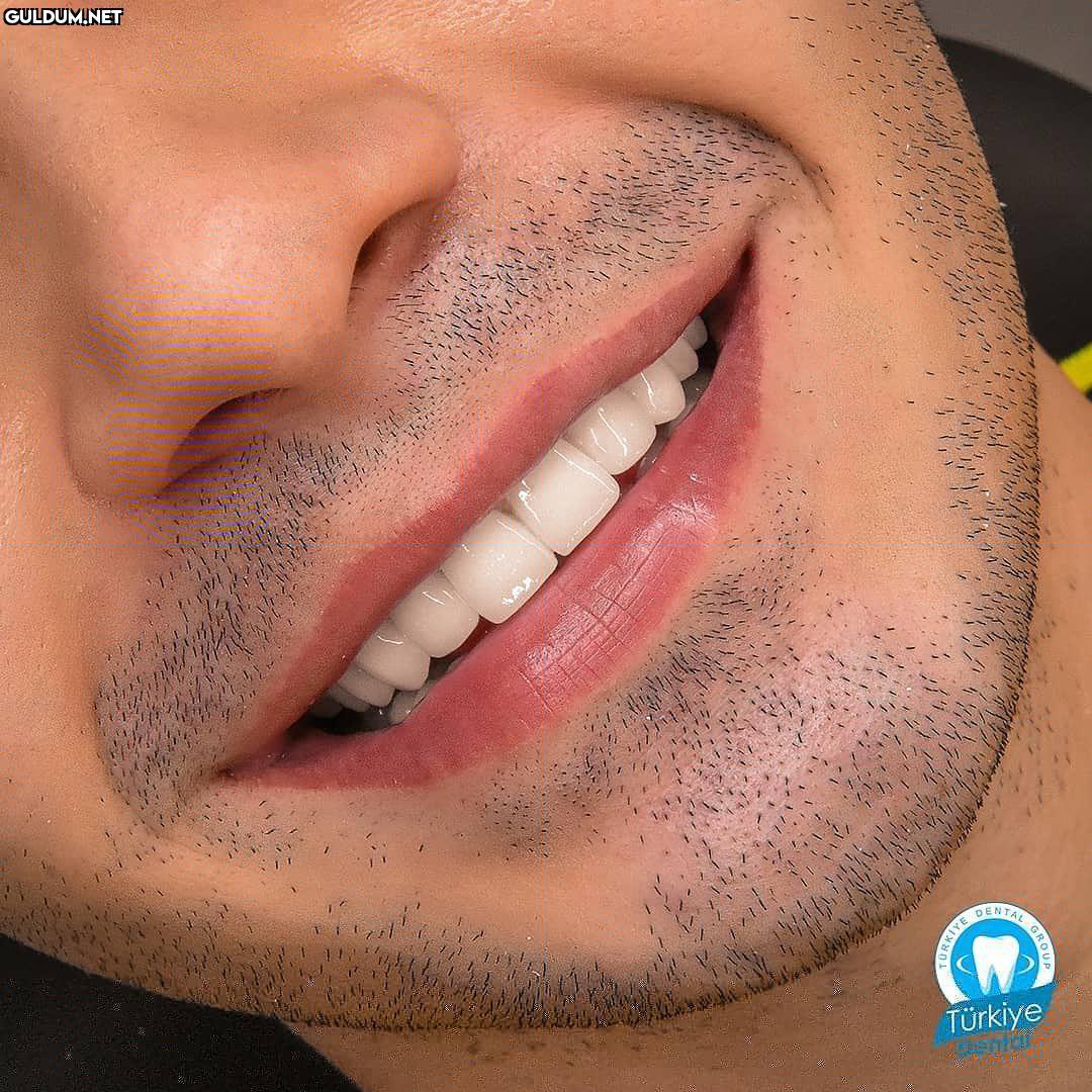 @turkeydental 👈...