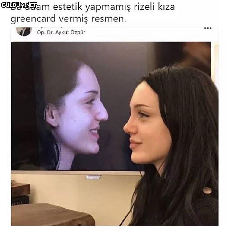 Bu adam estetik yapmamış...