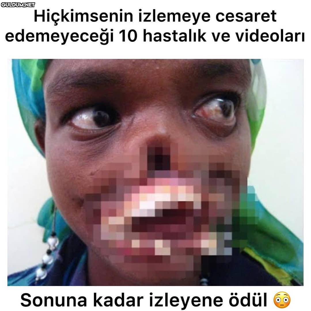 video sayfada paylaşıldı...