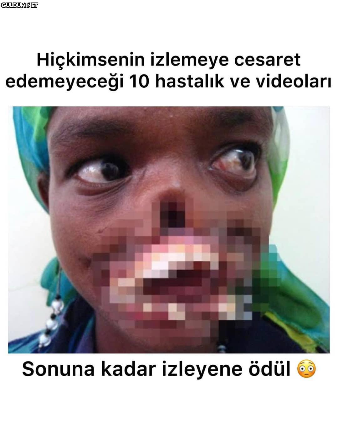 video sayfada paylaşıldı...