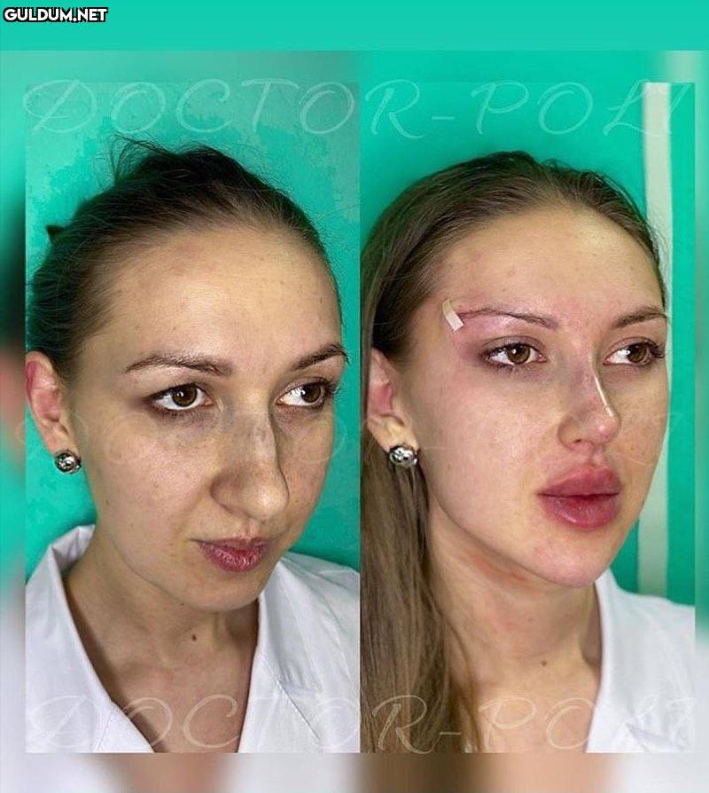 Paranın gücü DOCTOR-POA C...