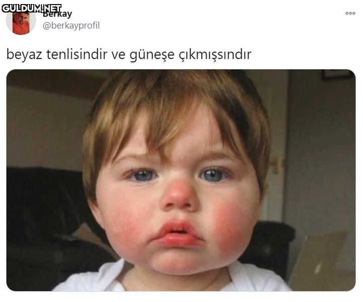 Berkay @berkayprofil 000...