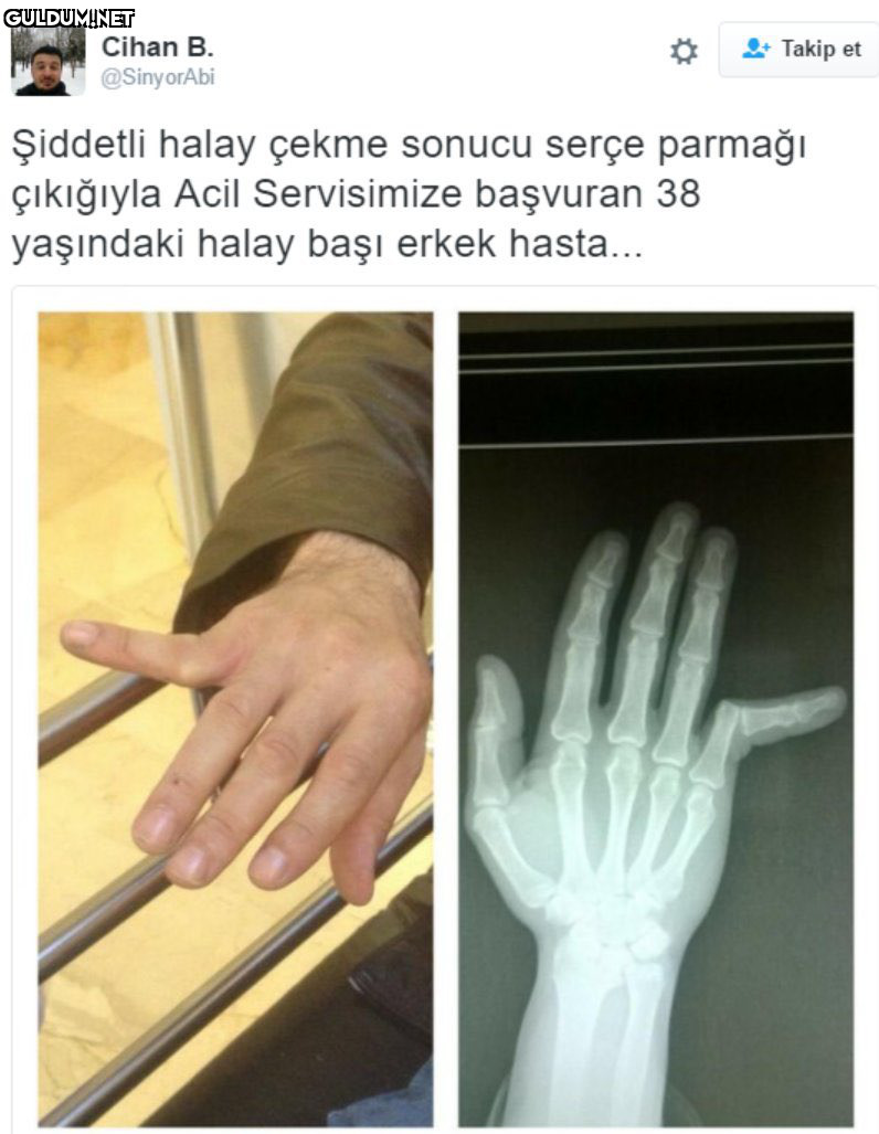 RT @mevzukurtlere1:  ...